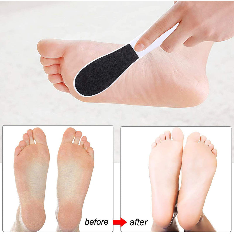 2 Pieces Double-Sided Foot File Foot Rasp File Dead Skin Remover Foot Scrubber Hard Skin Remover Foot Care for Wet and Dry Cracked Feet - NewNest Australia