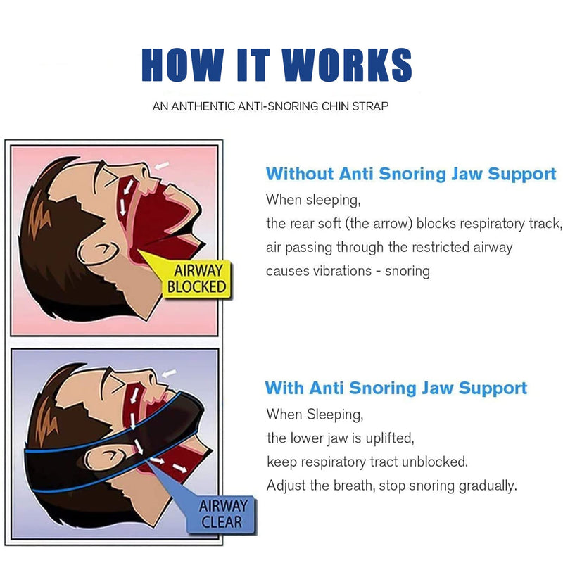 Viksaun Pack Of 2 Anti Snoring Chin Straps, Sleeping Aid Anti-Snoring, Snoring Device For Reduction Of Snoring, Professionally Effective Helps Against Snoring, Health Care Tools For Women Men (Pack Of 2) - NewNest Australia