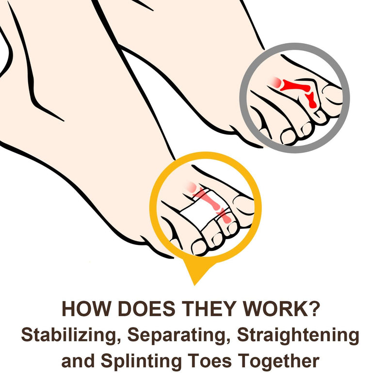 Welnove [6X] hammer toe spreaders, hammer toe correctors, hammer toe splints, toe bandages for correcting hammer toes, broken toes, crooked toes and overlapping toes - NewNest Australia