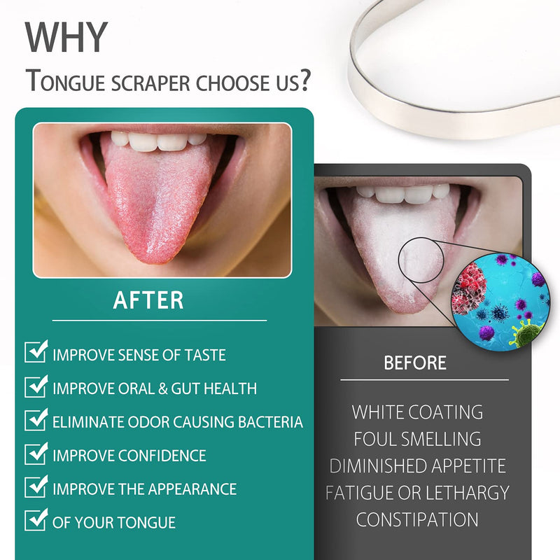 Tongue Cleaner With Travel Case, Tongue Scraper Stainless Steel, Tongue Scraper Cures Bad Breath And Maintains Oral Hygiene, Tongue Cleaner For Adults And Children, Easy To Clean, 2 Pieces U-Silver - NewNest Australia