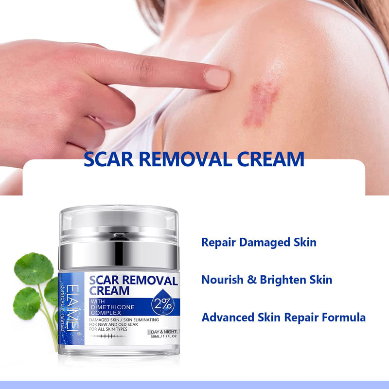 Scar Removal Cream, Skin Repair Cream for Old and New Scars, Scar Treatment Gel for Surgical Scars, Acne Scars, C-Section, Burns, Stretch Marks - NewNest Australia