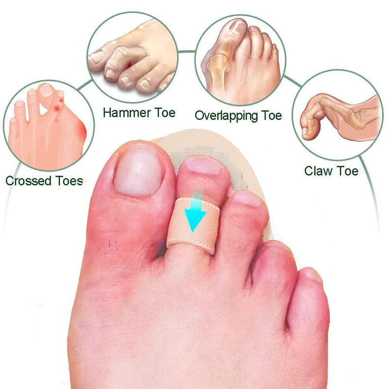 Mcvcoyh Adjustable 2 Loops Toe Splint, Hammer Toe Straightener with Cushion for Toe Claw, Curled & Crooked Toes - Support Guard Protector for Pre Post Surgery Broken Overlapping Toes 1 Pair - NewNest Australia