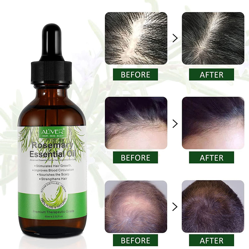 Rosemary Hair Growth Oil,Rosemary Essential Oil for Hair Growth,Hair Loss Treatment,Strengthens Hair,Rid of Itchy and Dry Scalp Refreshing Aromatherapy Oil for Men Women - NewNest Australia