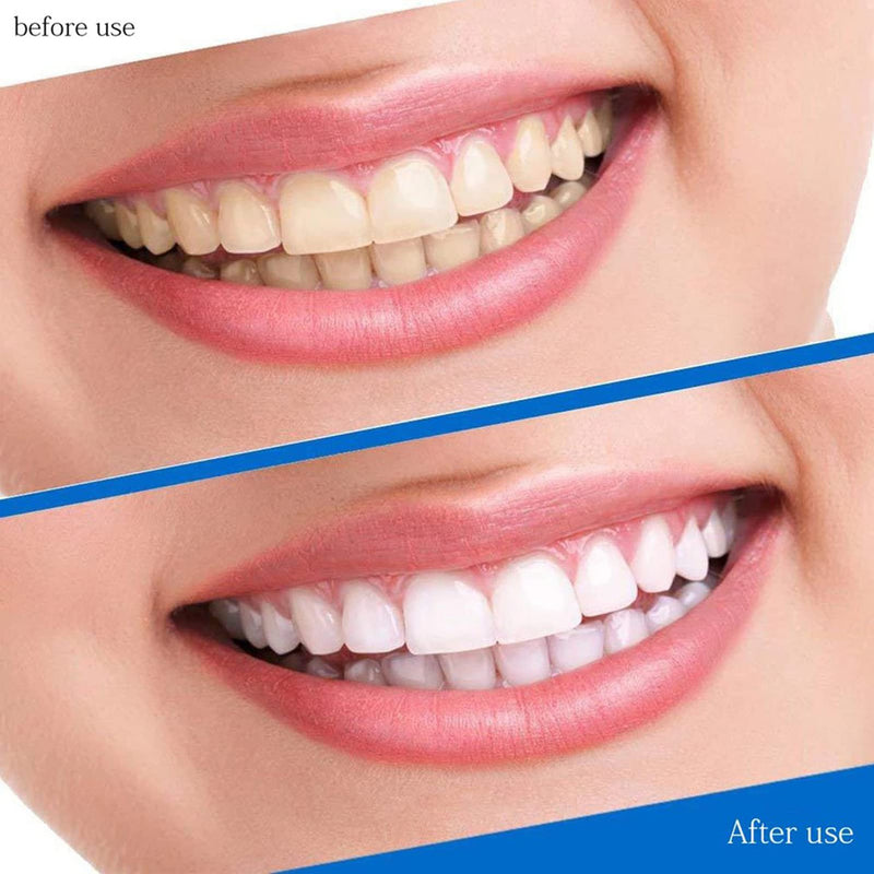 Teeth Whitening Strips 5D, Non-Sensitive Whitening Strips Strong Whitening Strips for Teeth, Professional and Safe Teeth Whitener Removes Coffee Tea Smoking & Wine Stains for Home Use 14PCS - NewNest Australia