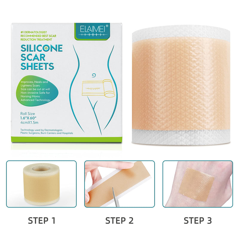 Professional Silicone Scar Sheets, Reusable Scar Sheets,Softens And Repairs Scars,Used For Scars Caused By Injuries, Burns, Acne, Stretch Marks, Washable(1.6” x 60”) - NewNest Australia