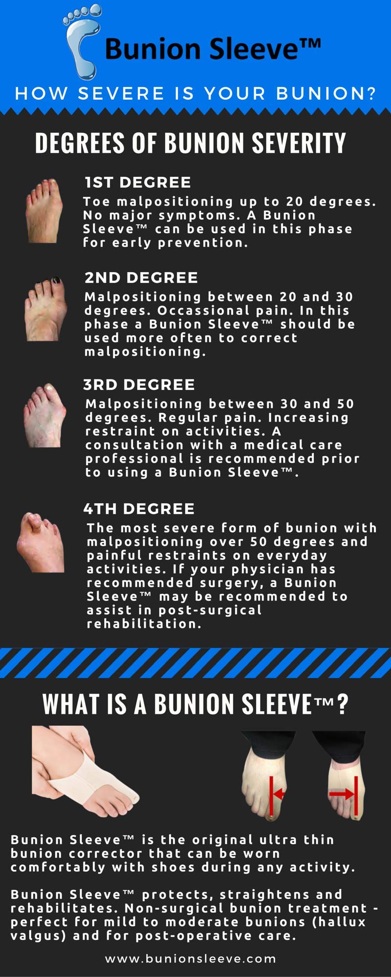 GH Bunion Sleeve | Ultra-Thin Bunion Corrector & Toe Straightener Bandage | Ideal for Sports & Active Wear | Orthopaedic Stretch-Fit Hallux Valgus Support Bandage Right XL: UK 11+ Beige - NewNest Australia