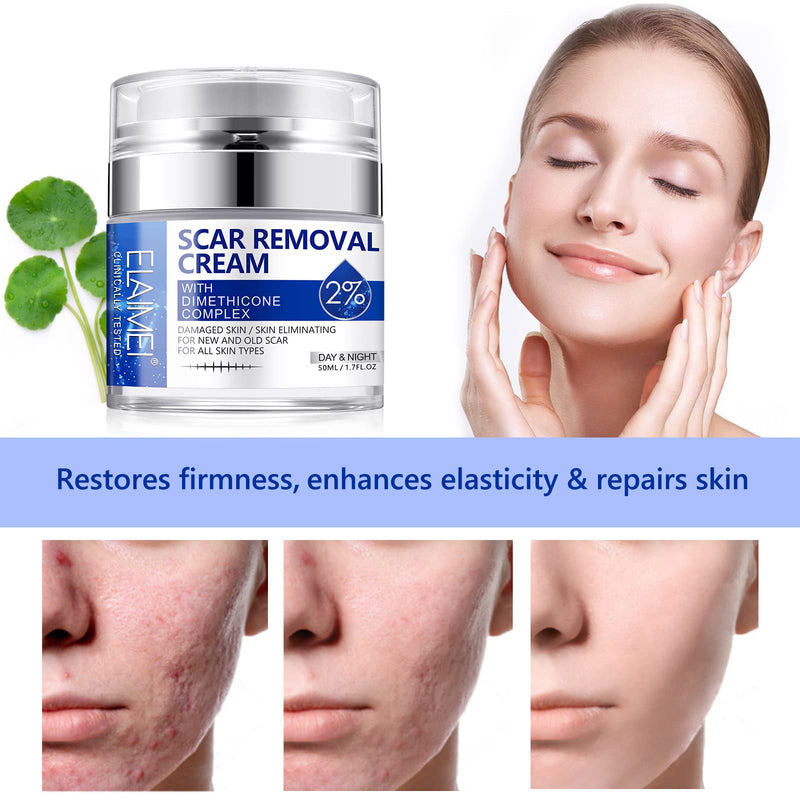 Scar Removal Cream, Skin Repair Cream for Old and New Scars, Scar Treatment Gel for Surgical Scars, Acne Scars, C-Section, Burns, Stretch Marks - NewNest Australia