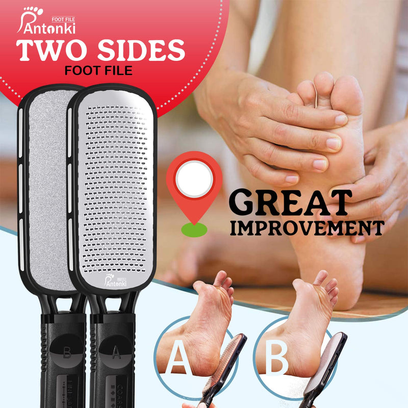 Foot File, Double Sided Foot Scrubber Callus Remover for Feet, Foot Rasp, Professional Pedicure Tool to Remove Callus, Plantar Wart, Corn - Skin-friendly Metal Foot Files for Hard Skin - NewNest Australia