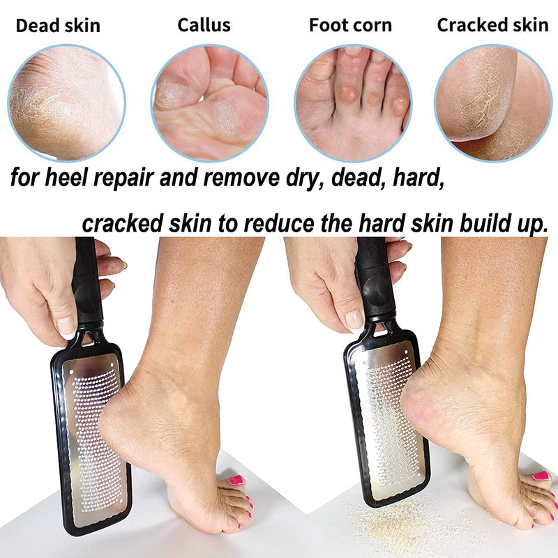 Angel Kiss Colossal Foot Rasp Foot File Callus Remover - Best Foot Care Pedicure Metal Surface Tool Remove Hard Skin. Can Be Used On Both Wet & Dry Feet, Surgical Grade Stainless Steel File - Black - NewNest Australia