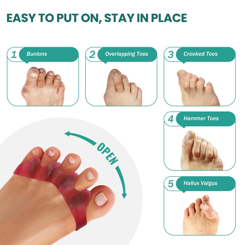 Welnove Toe Separators, Bunion Corrector - 8 Pieces Gel Toe Straighteners To Restore Original Shape Of Hammer Toe For Women And Men, Toe Spacers For Gifts (Deep Red) - NewNest Australia