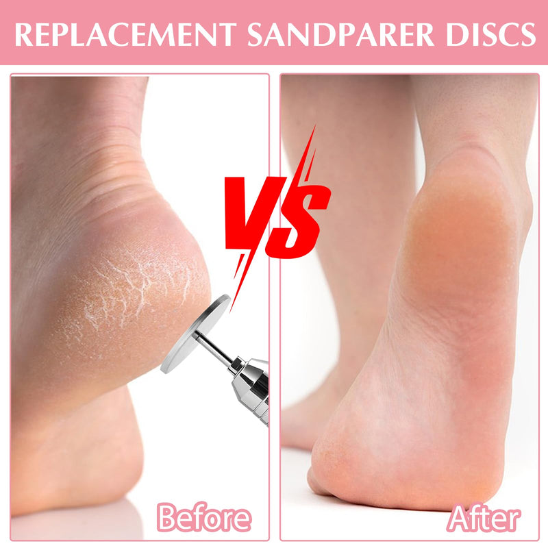 TIESOME 61 pieces sanding disc pedicure, 25 mm foot grinder sandpaper sanding discs replacement sandpaper disc tool sanding discs for hard dead skin cracked heel (style 1) style 1 - NewNest Australia