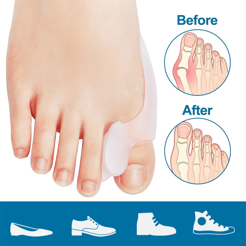 8 Bunion Cushion Protectors, Bunion Pad Bunion Protection, Bunion Corrector Toe Separator For The Big Toe, Bunion Shield For Hallux Valgus, Pain Relief, Bunion Pain, Pressure - NewNest Australia