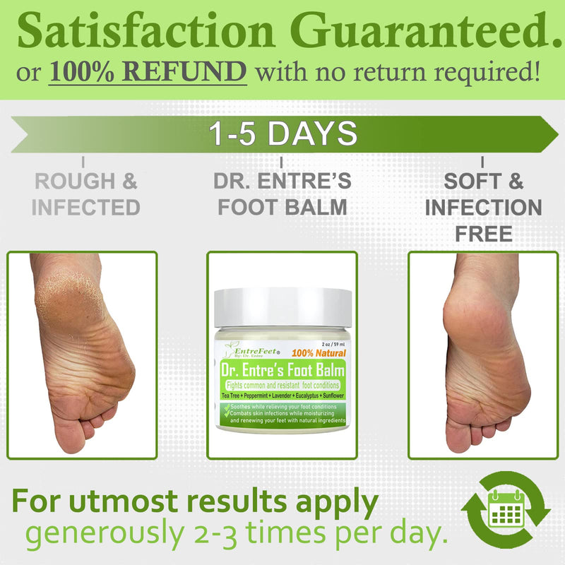 Dr. Entre's Antifungal Foot Balm: Tea Tree Oil & Shea Butter Based - Organic Treatment Cream for Athletes Foot, Dry Feet, Cracked Heels, Itching, and Odor - Foot Care E-Book Included - NewNest Australia