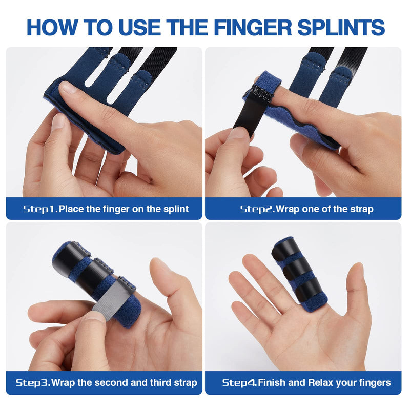 Echify Finger Splints - Pack Of 2 Improved Finger Support Snap Finger Splint Finger Protection With 3 Adjustable Fastening Straps Finger Bandage Finger Support For Broken Fingers And Osteoarthritis - NewNest Australia