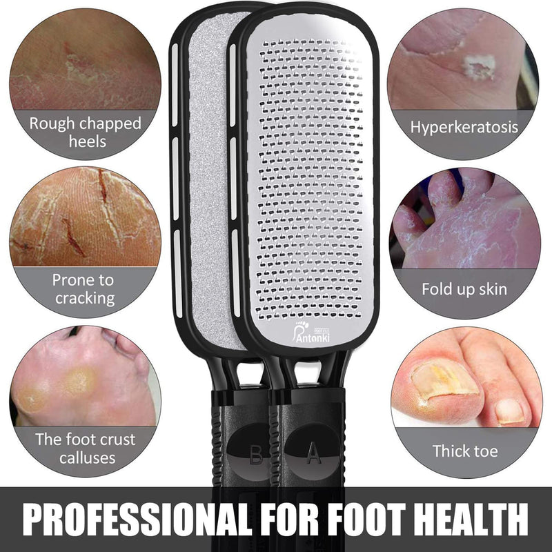 Foot File, Double Sided Foot Scrubber Callus Remover for Feet, Foot Rasp, Professional Pedicure Tool to Remove Callus, Plantar Wart, Corn - Skin-friendly Metal Foot Files for Hard Skin - NewNest Australia