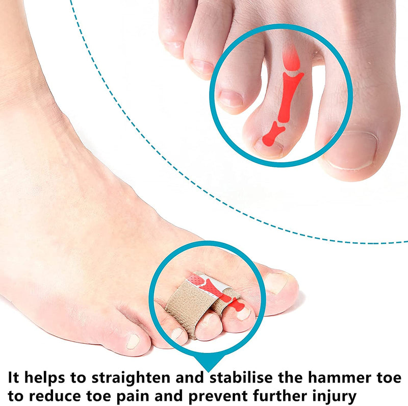 6Pcs Hammer Toe Straightener, Hammer Toe Splints, Toe Cushioned Bandages for Correcting Hammer Toes, Crooked Toes & Overlapping Toes，Protecting Curved Toes and Hammertoes, Overlapping Toe Protector - NewNest Australia