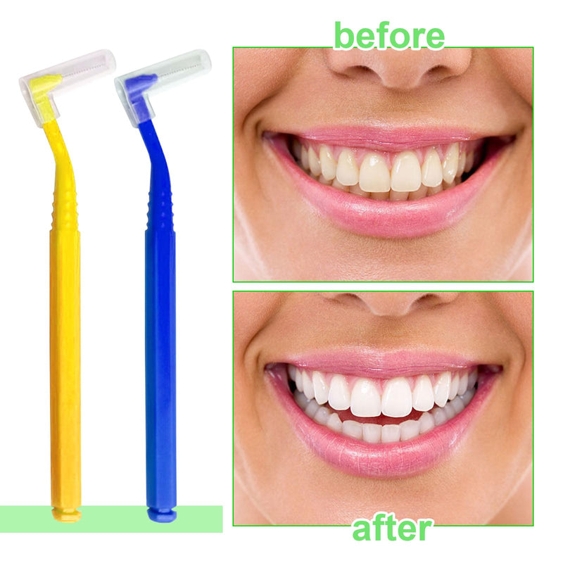 SKHAOVS Pack of 40 interdental brushes, push pull interdental brush, L-shaped interdental brushes, interdental cleaner brush with non-slip handle, oral care (5 colors) 5 colors - NewNest Australia