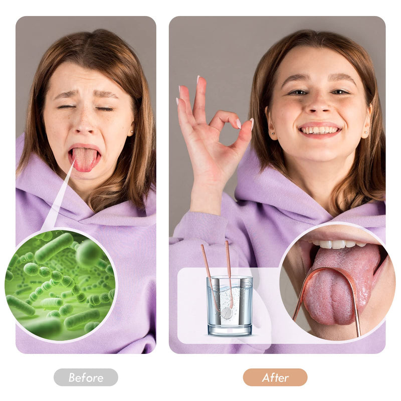 JUIDINTO 2pcs Tongue Scraper Kit, Medical Grade Stainless Steel Tongue Cleaner Set, Cleans the Tongue and Fights Bad Breath, Great for Oral Care, 100% BPA Free Tongue Scrapers for Adults & Kids - NewNest Australia