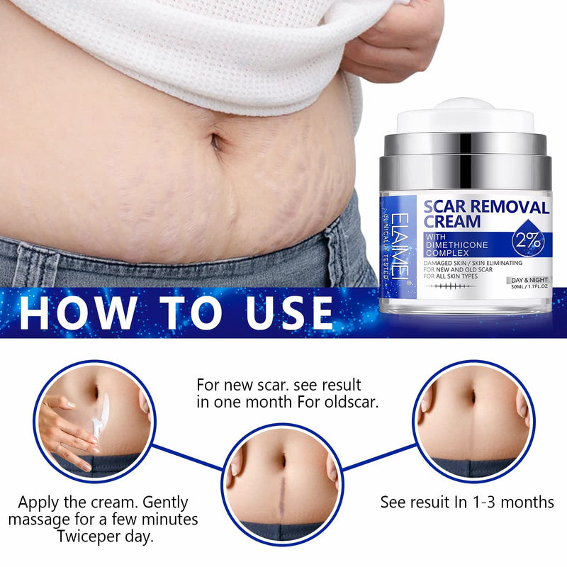 Scar Removal Cream,Rapid Repair of New and Old Scars,Soften and Flattens Scars Resulting from Surgery, Injury, Burns, C-Section et, Natural Scar Treatment for Women&Men - NewNest Australia