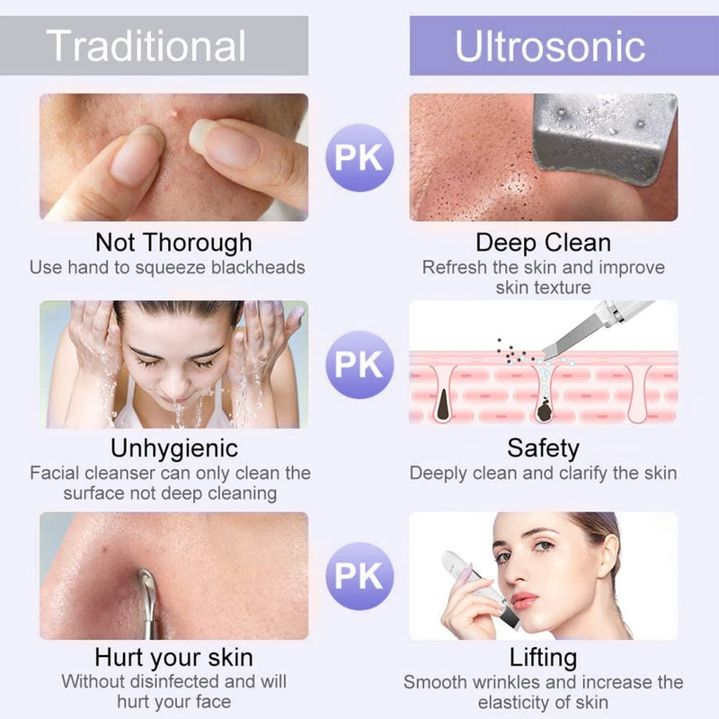 Skin Scrubber, ANLAN Ultrasonic EMS Ion Exfoliating Device Face Cleanser and Blackhead Remover Pores Cleaning Wrinkle Remover Comedone Extractor Skin Care With 4 Modes USB Rechargeable White-1 - NewNest Australia