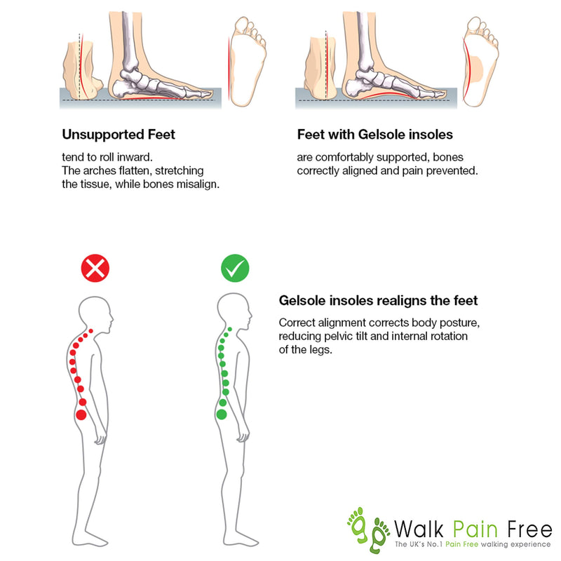 Orthotic Gel Insoles, Boost Magnetic Technology | Walk Pain Free COMFORT Insoles | Reduce Heel Pain, Plantar Fasciitis, Flat Feet | Supplying NHS & Emergency Services MEDIUM: 6 to 9 UK Green - NewNest Australia