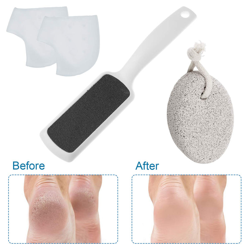 Foot Files Foot Scrubber Pumice Stones Pedicure Rasp Gel Heel Sleeves - Natural Foot File Exfoliation to Remove Dead Skin - NewNest Australia