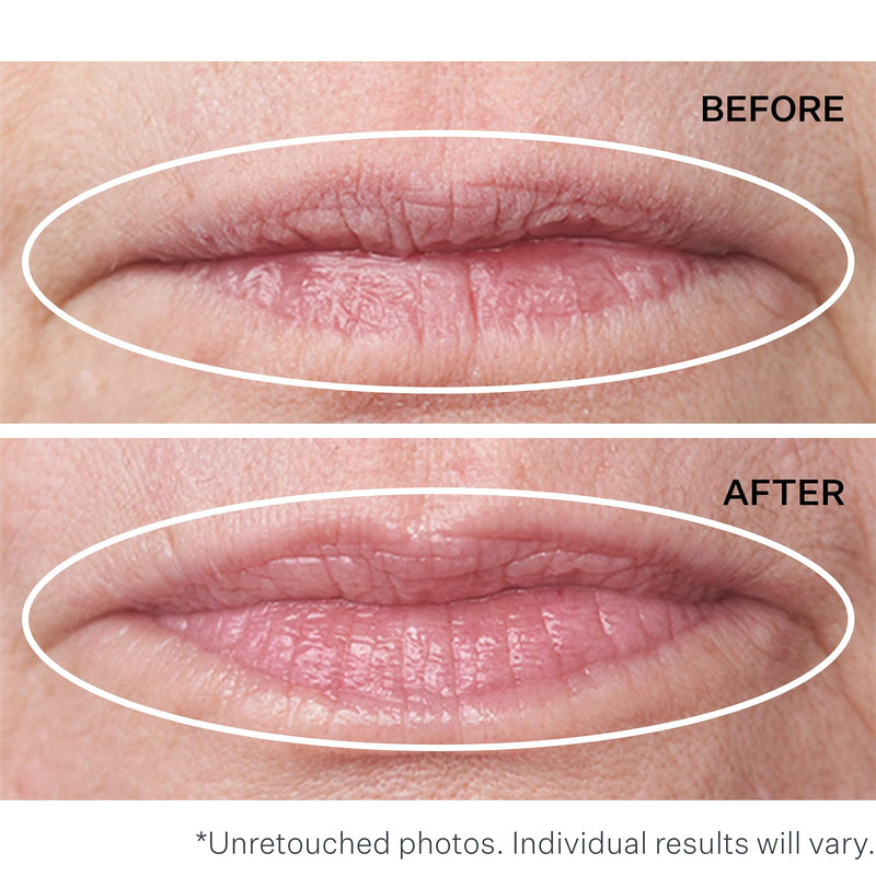 StriVectin Double Fix for Lips Plumping & Vertical Line Treatment, 028102 - NewNest Australia