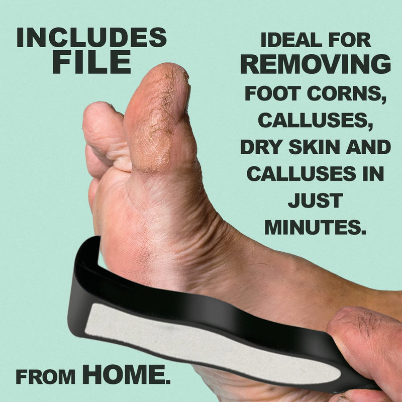 Simon&Tom Callus Remover - Exfoliating Peeling Gel 100 ml - Removes Hardness and Improves Cracked Heels - with Aloe Vera and Organic Argan Oil - Free of Parabens - Includes Nail File - Made in Spain - NewNest Australia