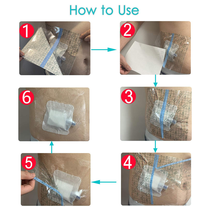 Waterproof Shower Cover Shields for Dialysis Port Picc Line Chest Catheter PD Peritoneal Dialysis Chemo Port Feeding Tube G-Tube Patient Shower Protector, 8"x8"(Pack of 25) 8x8 Inch (Pack of 25) - NewNest Australia