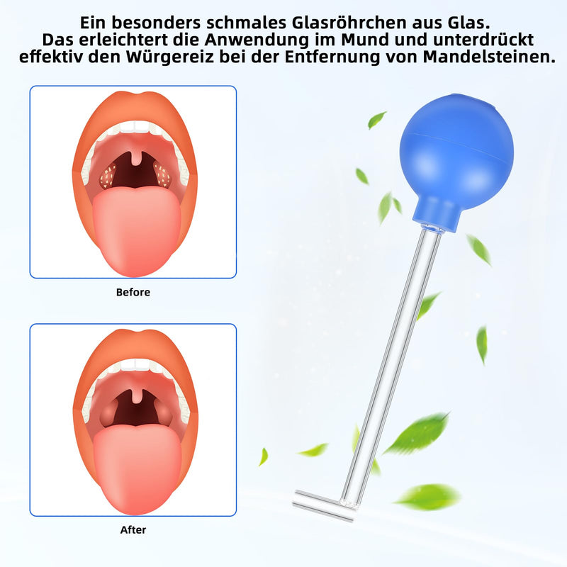Tonsil stone remover for removing tonsil stones | Almond stone cupping glass | Remove tonsil stones, effective mouth cleaning for fresher breath, removal of tonsil stones - NewNest Australia