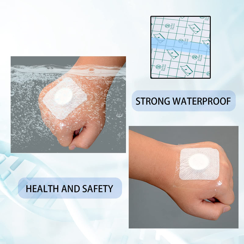 Waterproof Transparent Bandage, 15 Cm X 2 M Shower Plaster, Waterproof Plaster Roll, Transparent Plaster Roll, Medical Tape, Tattoo Plaster, Waterproof Bandage For Sports Showers - NewNest Australia