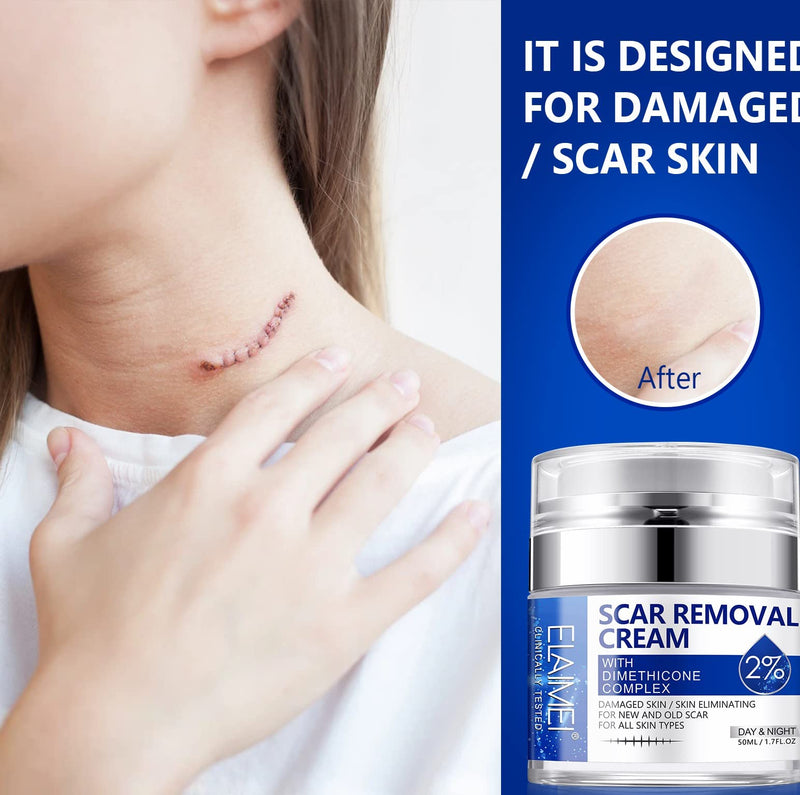 Scar Removal Cream,Rapid Repair of New and Old Scars,Soften and Flattens Scars Resulting from Surgery, Injury, Burns, C-Section et, Natural Scar Treatment for Women&Men - NewNest Australia