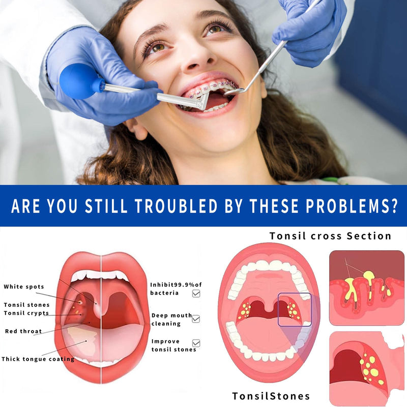 Tonsil stone remover for removing tonsil stones, removing tonsil stones, tonsil stone remover, tonsil stones, tonsil stone cupping glass, cupping glass for tonsil stones made of borosilicate glass - NewNest Australia