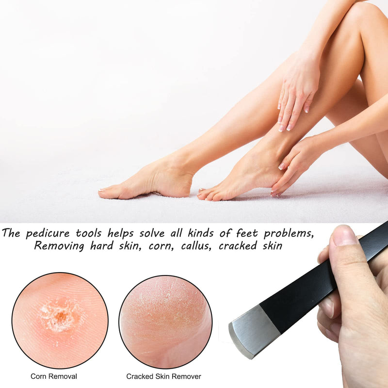Callus Slicer Foot Scraper Pedicure Knife Kits - 4 Pieces Professional Foot File Callus Remover Feet Razor Foot Rasp Hard Skin Heel Callus Removal - Foot Care Pedicure Set For Hand Feet - NewNest Australia