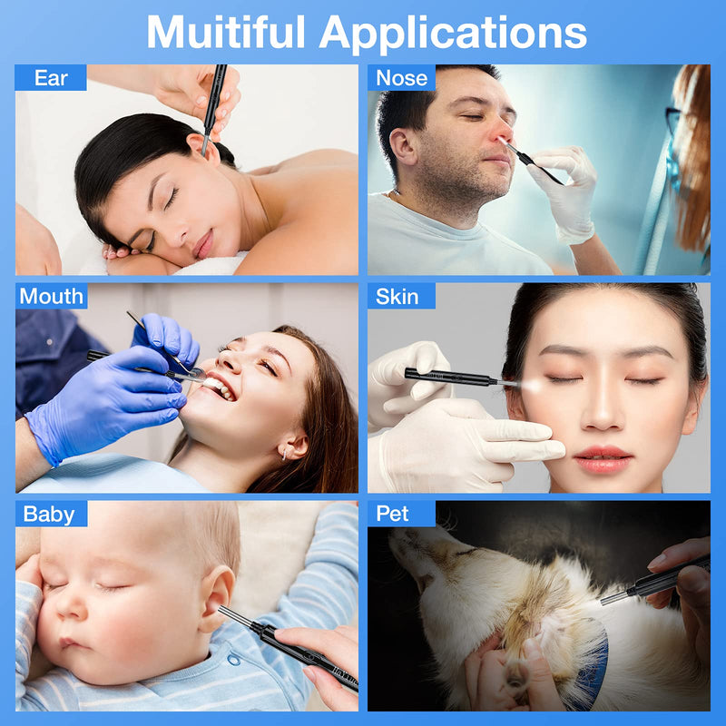 Ear Wax Removal with Camera, Earwax Remover Tool, 1296P FHD Wireless Ear Otoscope with 6 LED Lights, 6 Ear Spoon & 6 Traditional Tools Ear Wax Removal Kit for iPhone, iPad & Android Smart Phone Black - NewNest Australia
