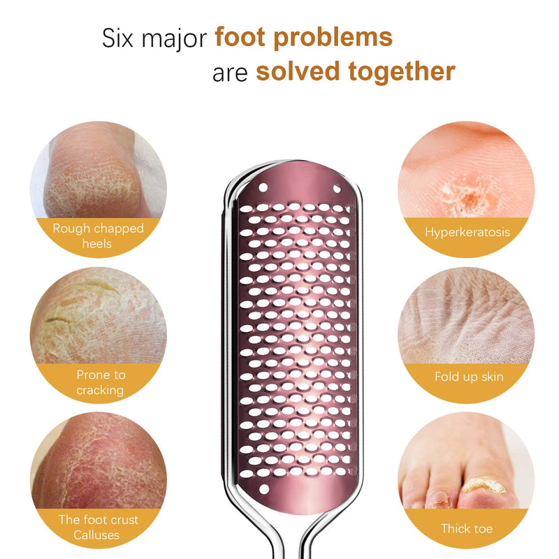 Callus File Callus Remover For Callus Removal Foot, Callus Rasp Foot Callus Remover Professional Stainless Steel Foot File Foot Rasp For Wet And Dry Feet (Rose Gold) - NewNest Australia