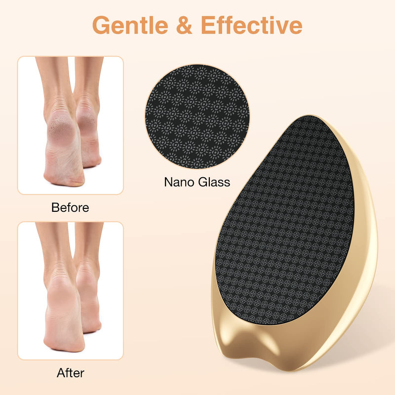 AnjoCare Nano Glass Foot File, Hard Skin Callus Remover, Foot Scraper Salon Home Pedicure Tool for Foot Beauty Care, Can Be Used on Both Wet/Dry Cracked Feet（Golden) Gloden - NewNest Australia