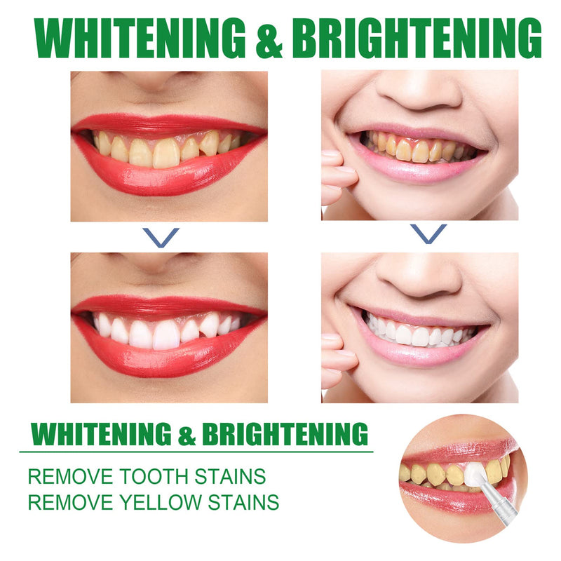 Teeth Whitening Pen Teeth Whitening Kit, Teeth Stain Remover to Whiten Teeth, Effective & Painless Whitening Teeth Whitening Gels eeth whitening Wand,Teeth whitening kit Accessories - NewNest Australia