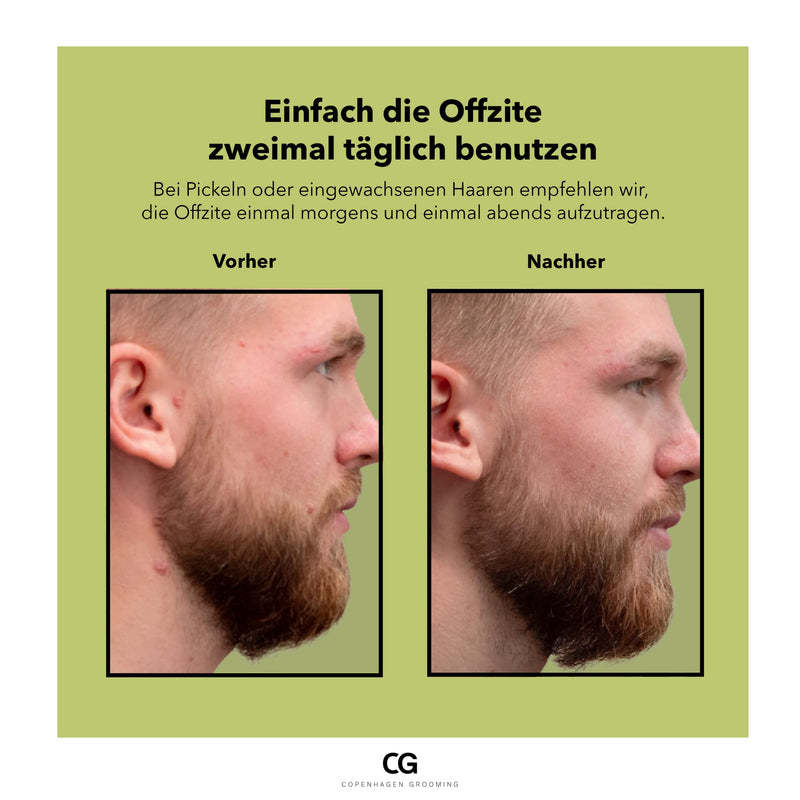 Copenhagen Grooming Offzite Zitstick - Anti Pimple Face Cream Men - Beard Care Agent Against Pimples & Ingrown Hairs - Anti Pimple Cream - NewNest Australia