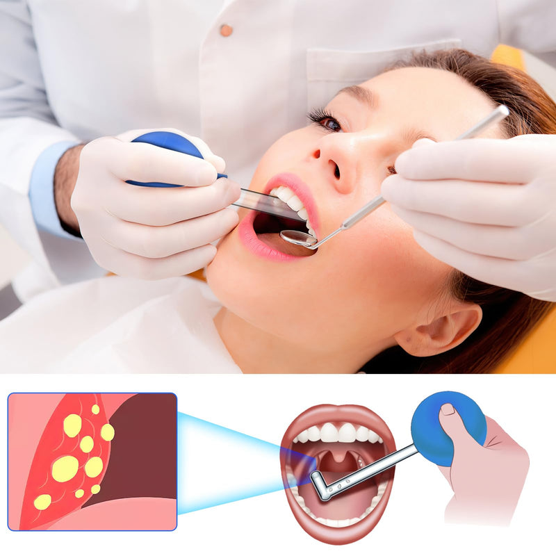Tonsil stone remover for removing tonsil stones | Almond stone cupping glass | Remove tonsil stones, effective mouth cleaning for fresher breath, removal of tonsil stones - NewNest Australia