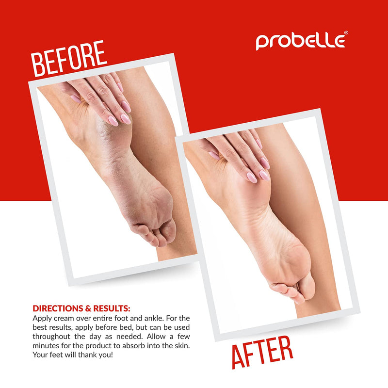 Probelle Advanced Total Foot Care: Soothes, Hydrates, Rejuvenates, Rough, Dry Cracked Feet for both Men and Women. 3 ounces - NewNest Australia