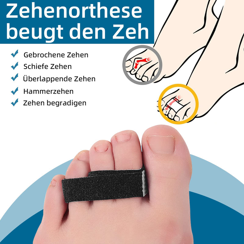 Eures Pack Of 10 Trigger Finger Splints, Adjustable Breathable Finger Protection, Finger Bandage For Small Finger, Middle Finger And Ring Finger, Hammer Toe Corrector, Overlapping Toe, Toe Corrector - NewNest Australia