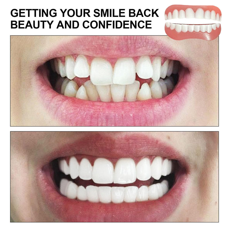 EUPSIIU 5 pairs of false teeth veneers, fake teeth, false teeth veneers, cosmetic tooth cover, cosmetic veneers teeth women men temporary dentures for bad teeth 10 pieces - NewNest Australia