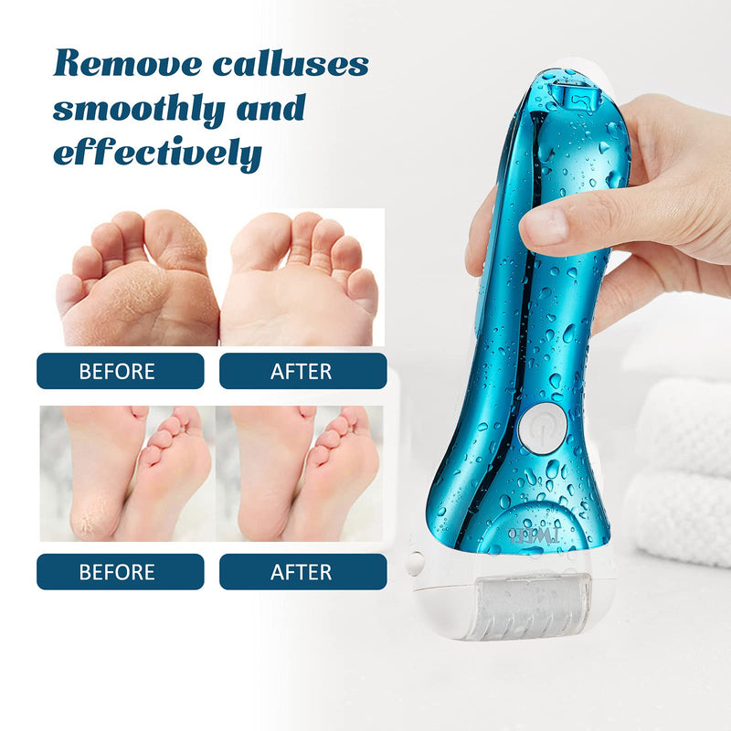 Electric Foot Callus Remover, Rechargeable Electronic Foot File Pedicure Kits, Electric Callus Remover for Feet, Foot Scrubber Dead Skin Remover, Professional Foot Care for Dead Skin Chromed Blue - NewNest Australia