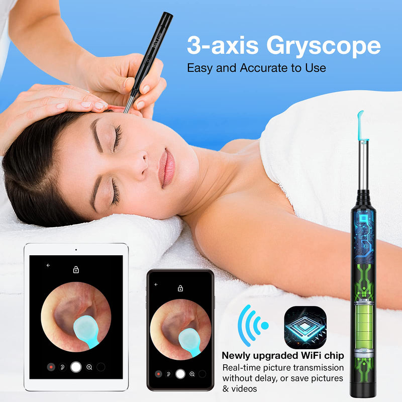 Ear Wax Removal with Camera, Earwax Remover Tool, 1296P FHD Wireless Ear Otoscope with 6 LED Lights, 6 Ear Spoon & 6 Traditional Tools Ear Wax Removal Kit for iPhone, iPad & Android Smart Phone Black - NewNest Australia