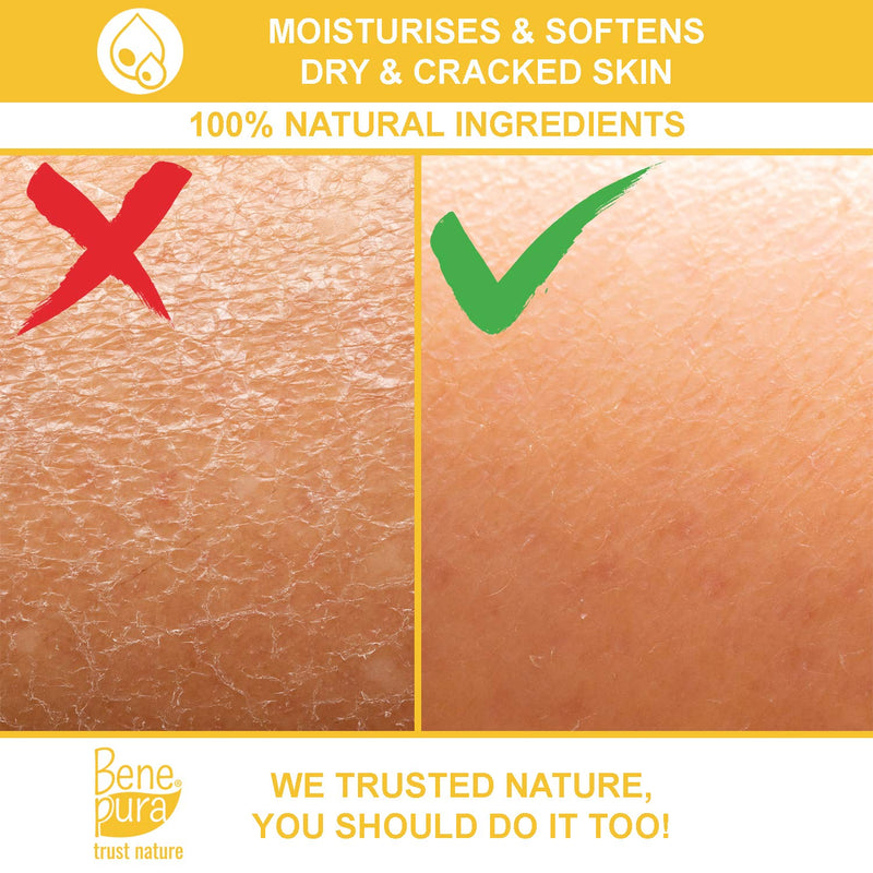 BenePura Propolis Ointment - Itch Relief Cream - Eczema Cream for Adults - Dry Foot Cream for Cracked Heels and Dry Skin - Cracked Heel Repair Cream - Natural Propolis Cream with 30% Propolis - 40 ml - NewNest Australia