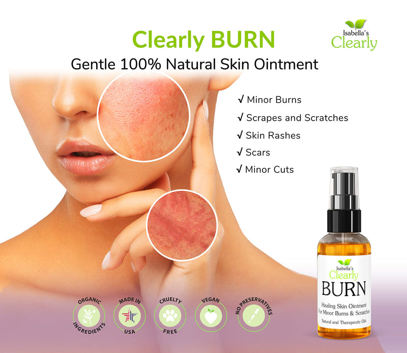 Isabella's Clearly Burn Soothing Aloe Vera Ointment for Skin Burns, Scalds, Cuts, Scrapes, Wounds, Sunburn Relief with Olive Oil and Lavender | Fast Acting Natural Remedy Made in USA - NewNest Australia