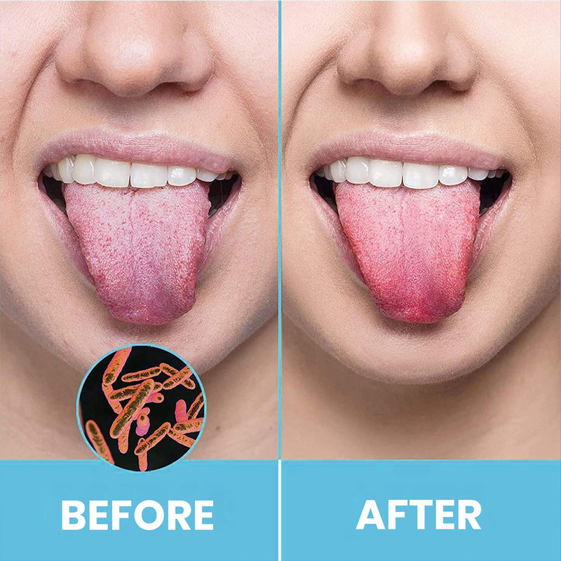 Hokin Tongue Scraper For Adults Tongue Cleaner Stainless Steel Bad Breath Fight 100% Metal Tongue Scraper Cleaner Men And Women Tongue Brush Oral Hygiene Product (2 Pieces Oral Care Pack) - NewNest Australia