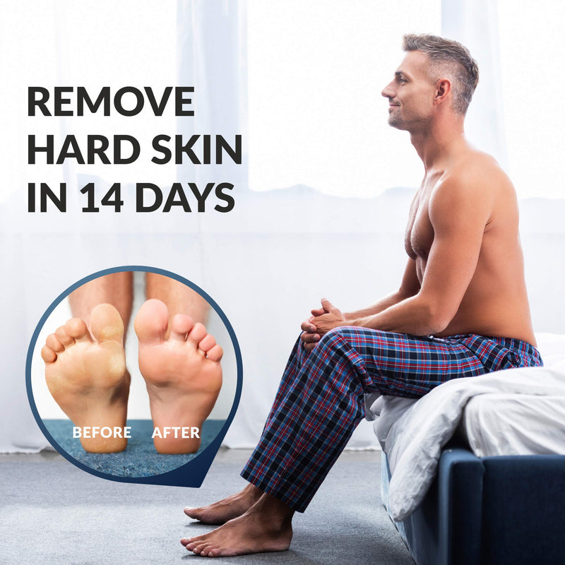 Baby Feet Foot Peel Mask Foot Masks for Men remove hard skin Exfoliating Socks Callus Remover pedicure Exfoliator Foot Peeling Mask Foot Care Kit for cracked Feet Pack 1 Pair (up to size 12) - NewNest Australia