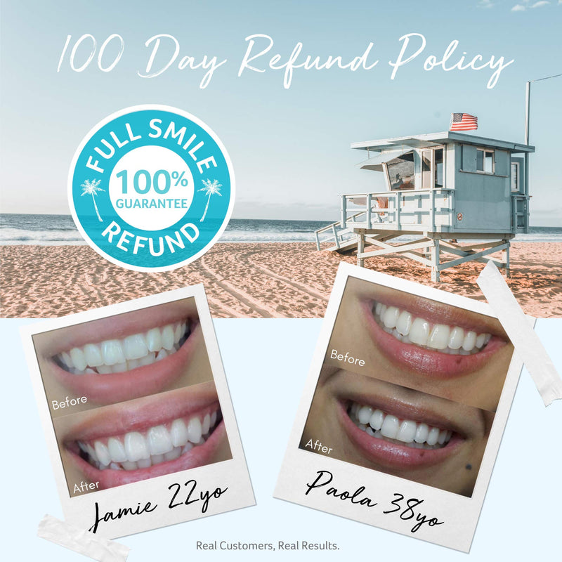 Cali White Teeth Whitening Gel Refills, 35% Carbamide Peroxide, Natural, Vegan, Organic Whitener for Sensitive Tooth Bleach, Gels Made in USA, 3X 5mL Syringes, Use with UV or LED Light & Trays - NewNest Australia